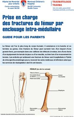 Prise En Charge Des Fractures Du F Mur Par Enclouage Intra M Dullaire