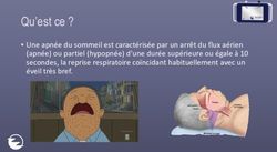 Qu'est ce ? Une apnée du sommeil est caractérisée par un arrêt du flux aérien (apnée) ou partiel (hypopnée) d'une durée supérieure ou égale à 10 ...