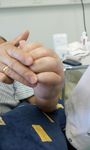 UN OED&Egrave;ME QUI R&Eacute;SISTE QUAND FAIRE APPEL AU PSYCHIATRE - DR MED MICH&Egrave;LE DEPAIRON, DR MED MARIA IAKOVA, DR MED JEAN SAVOY 14&Egrave;ME CONGR&Egrave;S DE LA SAFW ...
