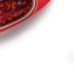 LES EFFETS IND&Eacute;SIRABLES - DE LA VACCINATION COVID-19 Une synth&egrave;se bas&eacute;e sur les donn&eacute;es de pharmacovigilance mondiales