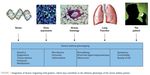 L'asthme : d&eacute;pistage et traitement - 51e CONGRES DE L'A.M.U.B - Olivier Michel Clinique d'Immuno-allergologie - AMUB