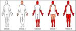 Guide de pratique en ergoth&eacute;rapie pour la client&egrave;le atteinte de dystrophie myotonique de type 1 (DM1), ph&eacute;notype adulte