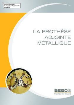 LA PROTHÈSE ADJOINTE MÉTALLIQUE - SOUFI DENTAL Equipement ...