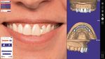 L'avenir de la dentisterie esthétique - Smile Creator - exocad.com