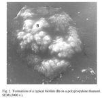 Infection de proth&egrave;se vasculaire