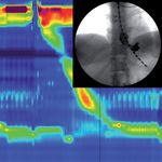 SOLAR GI HRM MANOMÉTRIE HAUTE RÉSOLUTION INNOVANTE ET ACCESSIBLE - PROGRAMME D'ANALYSE DES DONNÉES QUICKVIEW REPRÉSENTATION TOPOGRAPHIQUEET 3D DES ...