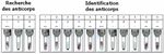 LOGICIEL IH-ABID : UNE AIDE PR&Eacute;CIEUSE POUR L'IDENTIFICATION DES ANTICORPS IRR&Eacute;GULIERS - SPECTRA DIAGNOSTIC