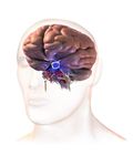 Cas cliniques et recommandations - Toxicit&eacute;s endocriniennes de l'immunoth&eacute;rapie Dr Amandine Berdelou