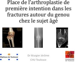 Place de l'arthroplastie de première intention dans les fractures autour du genou chez le sujet âgé - Dr Murgier Jérôme CHU Toulouse