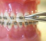 Formation complète en orthodontie pour omnipraticiens
