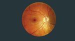 EXAMEN PROPHYLACTIQUE - Evaluation de la situation et examen prophylactique de vos yeux - Spörri Optik