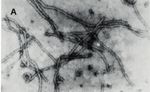 Plum pox virus - la sharka - Bilan de la surveillance en 2017