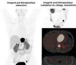 10 CEPCM - CLIP CENTRE D'ESSAIS PR&Eacute;COCES EN CANC&Eacute;ROLOGIE DE MARSEILLE - AP-HM