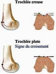 Imagerie de l'appareil extenseur du genou - Dr Eric Fumi&egrave;re CHU Charleroi 27/01/2018 - sfmss
